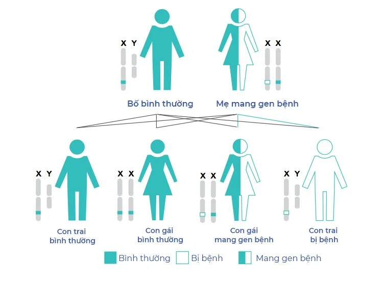 Pompe là bệnh di truyền