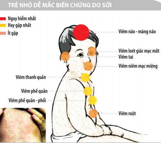 Hãy phòng chống bệnh trước khi mắc và xảy ra các biến chứng bệnh