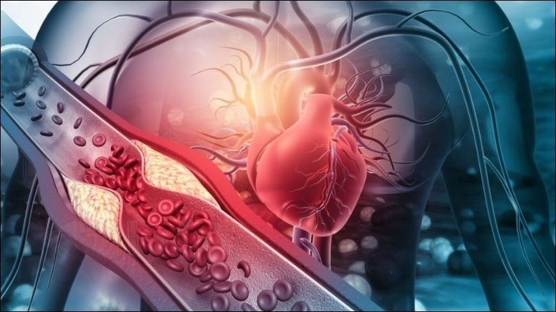 Hiểu rõ bệnh tim mạch: nguyên nhân, triệu chứng và phương pháp điều trị