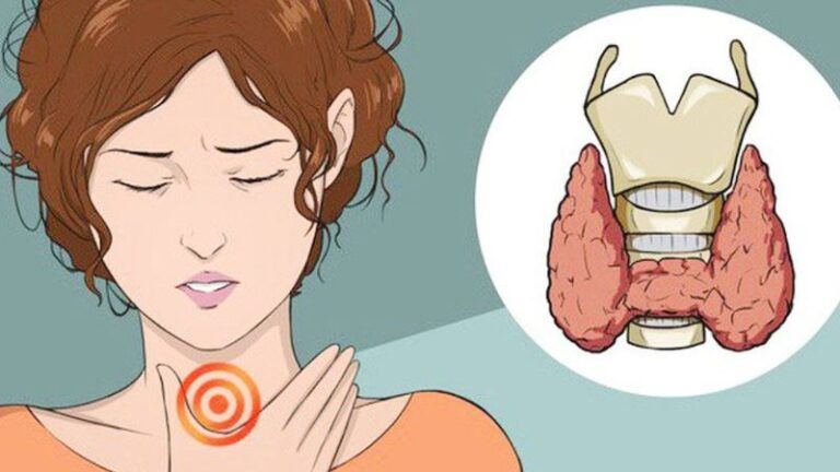 Hình ảnh minh họa vị trí tuyến giáp trong cơ thể. 