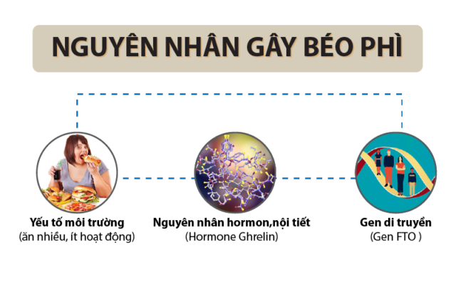 Nguyên nhân chủ yếu gây béo phì độ 1