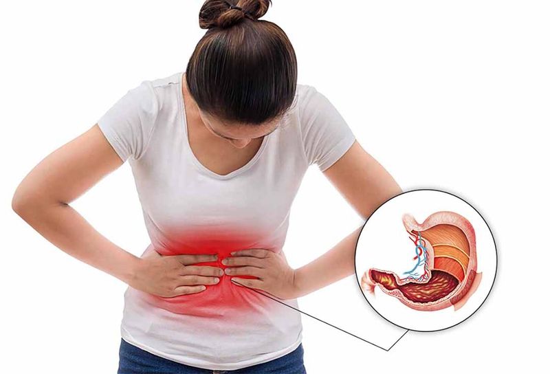 Môn vị bất thường sẽ dễ gây câc triệu chứng khó chịu về tiêu hoá