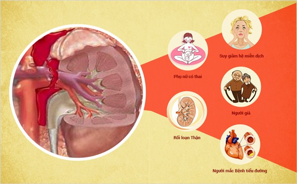 Các đối tượng nguy cơ dễ bị thận – tiết niệu