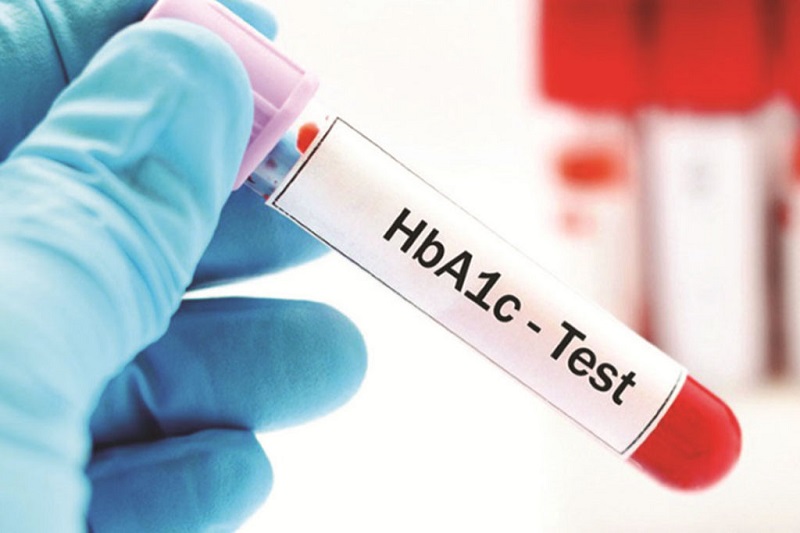 Người bệnh tiểu đường nên làm xét nghiệm HbA1C ít nhất hai lần một năm