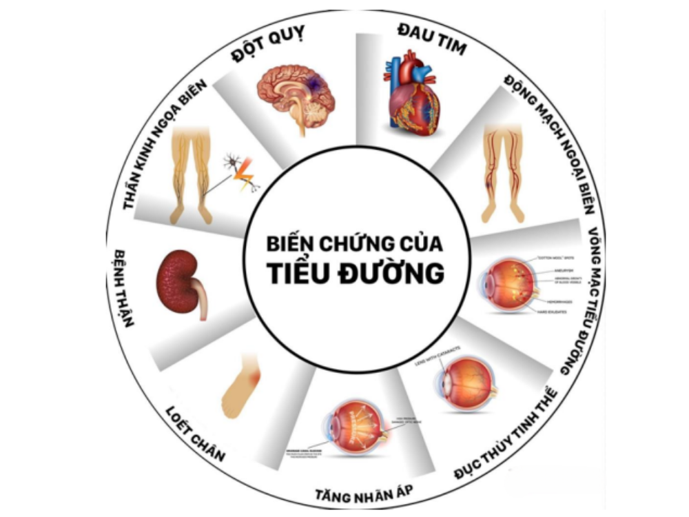 Tiểu đường tuýp 2 gây nên nhiều biến chứng nguy hiểm