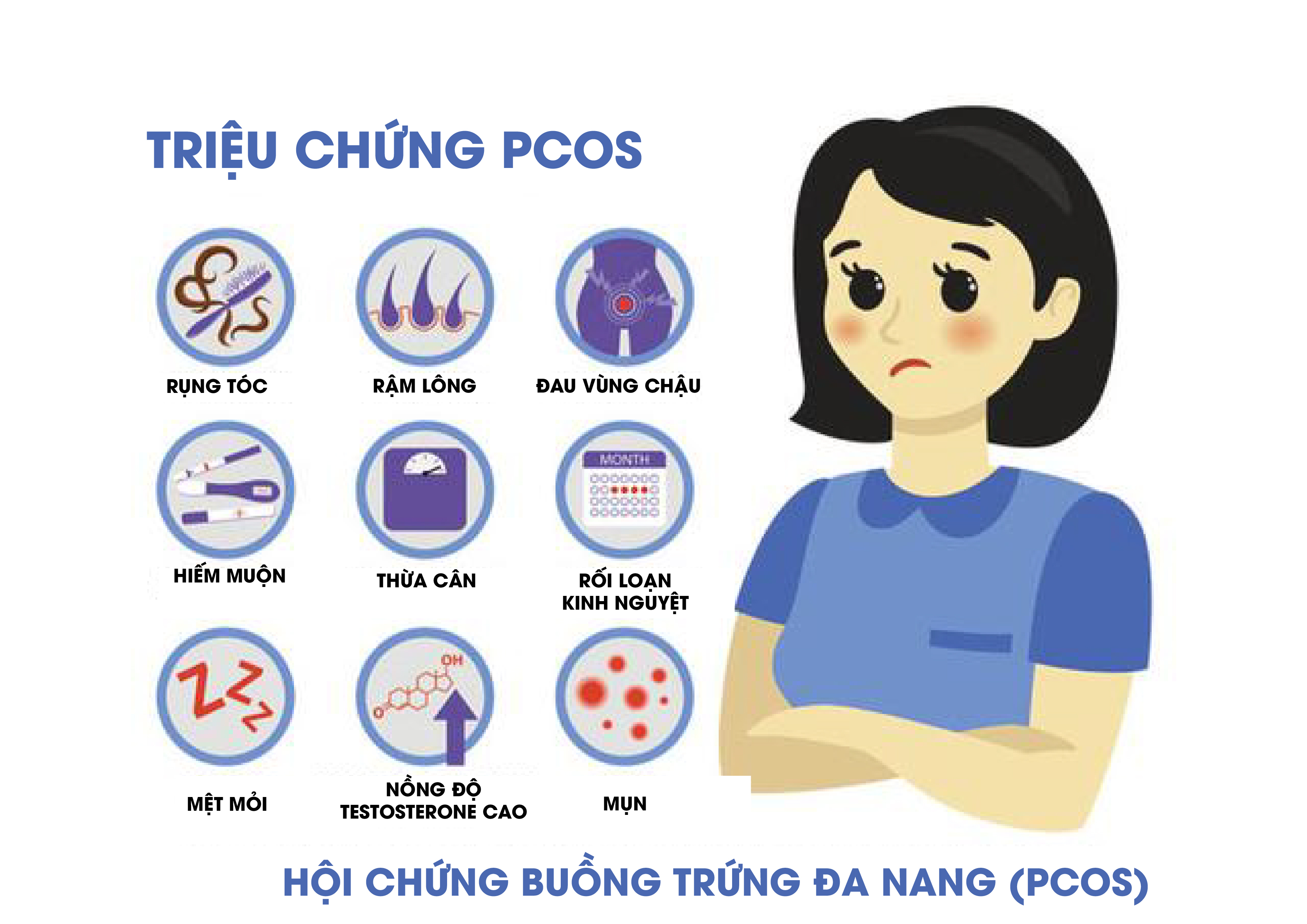 Triệu chứng của hội chứng đa nang buồng trứng