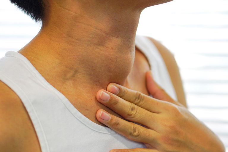 Nguyên nhân bướu giáp keo