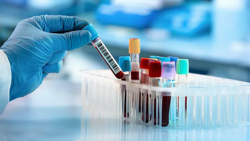 Chẩn đoán chính xác là cơ sở để đưa ra các biện pháp giảm nhẹ triệu chứng hiệu quả 