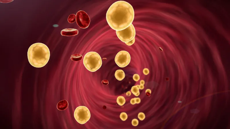 Xét nghiệm cholesterol giúp đánh giá nguy cơ bệnh tim mạch