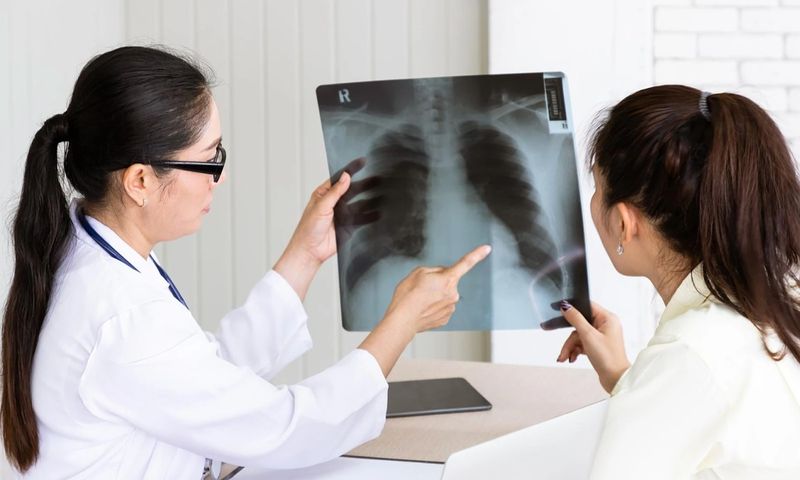 Hình ảnh bác sĩ đang giải thích cấu trúc phế nang thông qua phim chụp X-quang phổi.