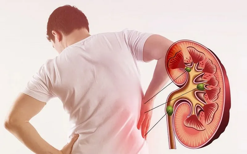 Minh hoạ xét nghiệm nước tiểu ở bệnh nhân tiểu đường