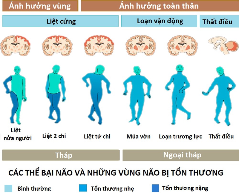 Các thể bại não