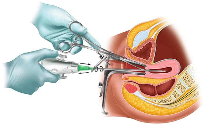 Trang thiết bị hiện đại và phòng thủ thuật vô trùng giúp giảm thiểu tối đa các biến chứng nguy hiểm 