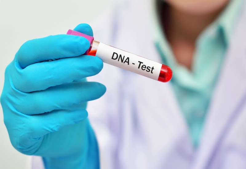 Xét nghiệm DNA là một phương pháp chẩn đoán bệnh loạn dưỡng cơ