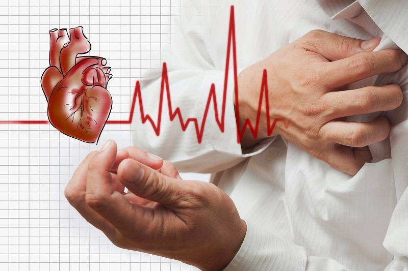 Cao Huyết Áp: Hướng Dẫn Toàn Diện Về Nguyên Nhân, Triệu Chứng Và Cách Điều Trị