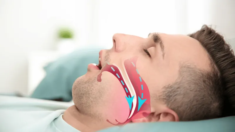 Tuyến mồ hôi giúp cơ thể điều hòa nhiệt độ và loại bỏ một số chất thải