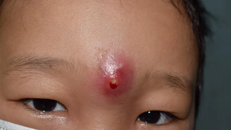 Các đợt nhiễm trùng tái phát là dấu hiệu cảnh báo hệ miễn dịch đang gặp vấn đề nghiêm trọng 