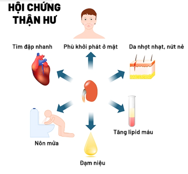 Triệu chứng lâm sàng của hội chứng thận hư