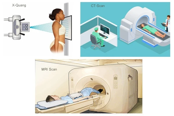 Các xét nghiệm lâm sàng giúp chẩn đoán chấn thương cột sống chính xác hơn