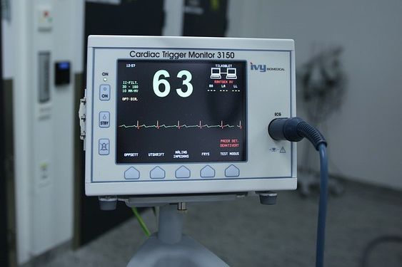 Phương pháp điện tâm đồ (ECG) có thể giúp phát hiện các bất thường của tim