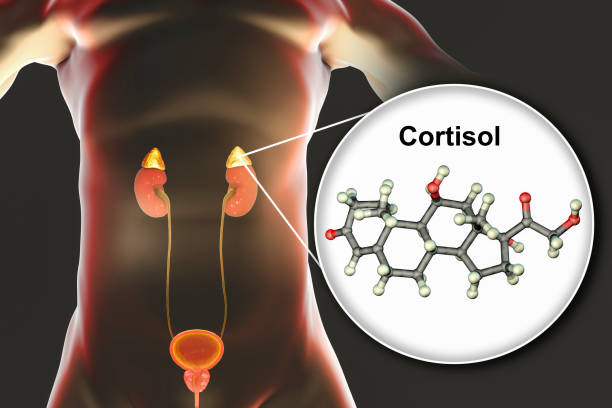 Hội chứng Cushing là một bệnh lý nội tiết do tăng sản xuất cortisol trong cơ thể