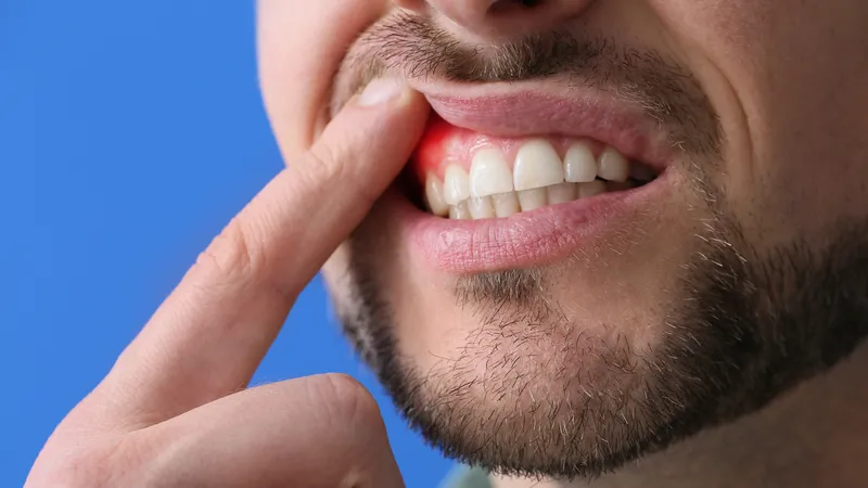 Các khối u xương hàm cần được phân loại chính xác để có phác đồ điều trị phù hợp 