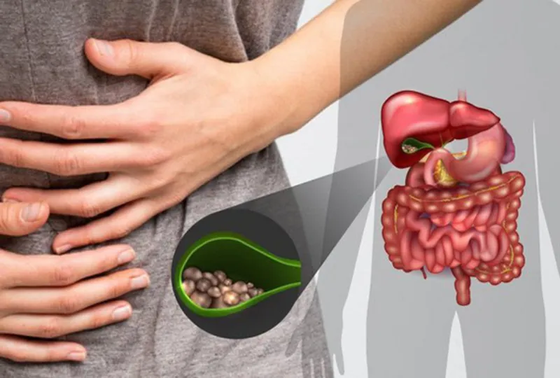 Chống chỉ định cho người sỏi mật, loét dạ dày, đại tràng, trẻ em