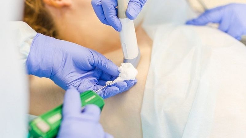 Quá trình sinh thiết thường diễn ra nhanh chóng với sự hỗ trợ của thiết bị chẩn đoán hình ảnh