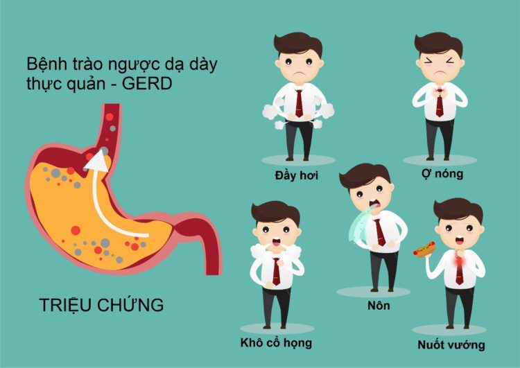 Triệu chứng trào ngược dạ dày thực quản