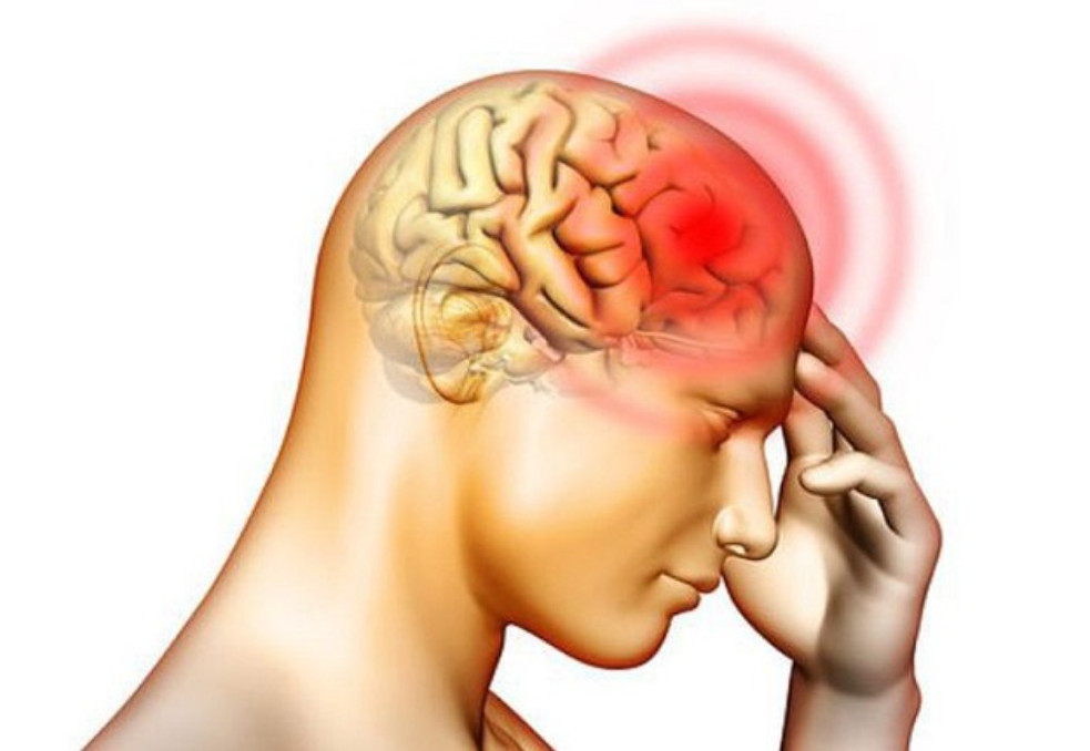 Đau đầu Arnold thường bị nhầm lẫn với các loại đau đầu thông thường