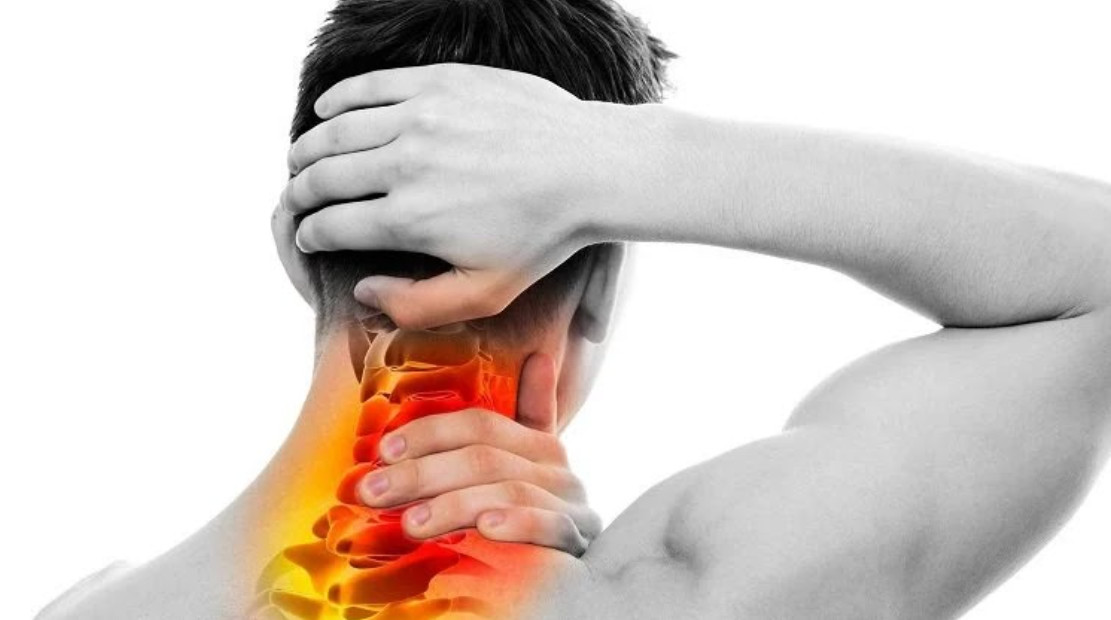 Chấn thương cột sống cổ cũng có thể là nguyên nhân gây ra đau đầu Arnold