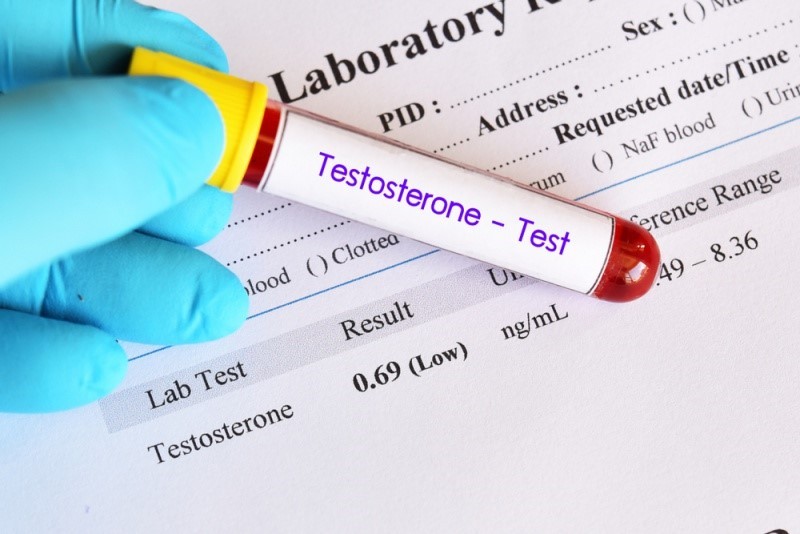 Xét nghiệm Testosterone để chẩn đoán suy giảm Testosterone