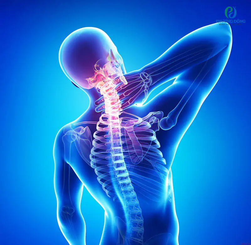 Chẩn đoán đau lưng trên