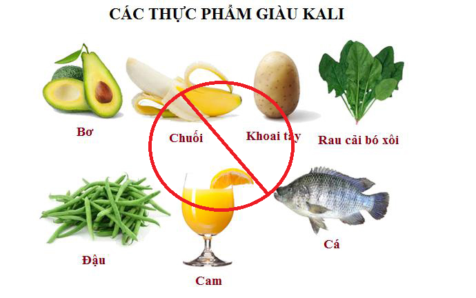 Thực phẩm không nên ăn khi bị thận -  tiết niệu