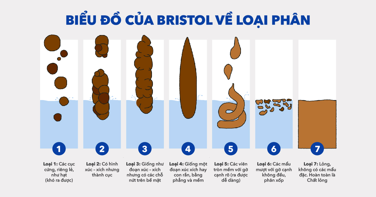 Biểu đồ phân Bristol (tình trạng phân loại 1 và 2 thể hiện trình trạng táo bón)