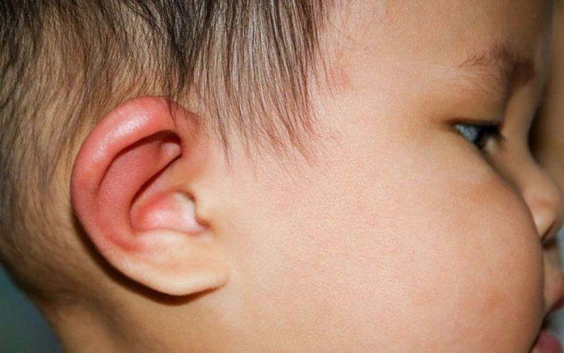 Nổi hạch sau tai ở trẻ nhỏ có thể xuất hiện dưới dạng khối nhỏ nằm dưới da