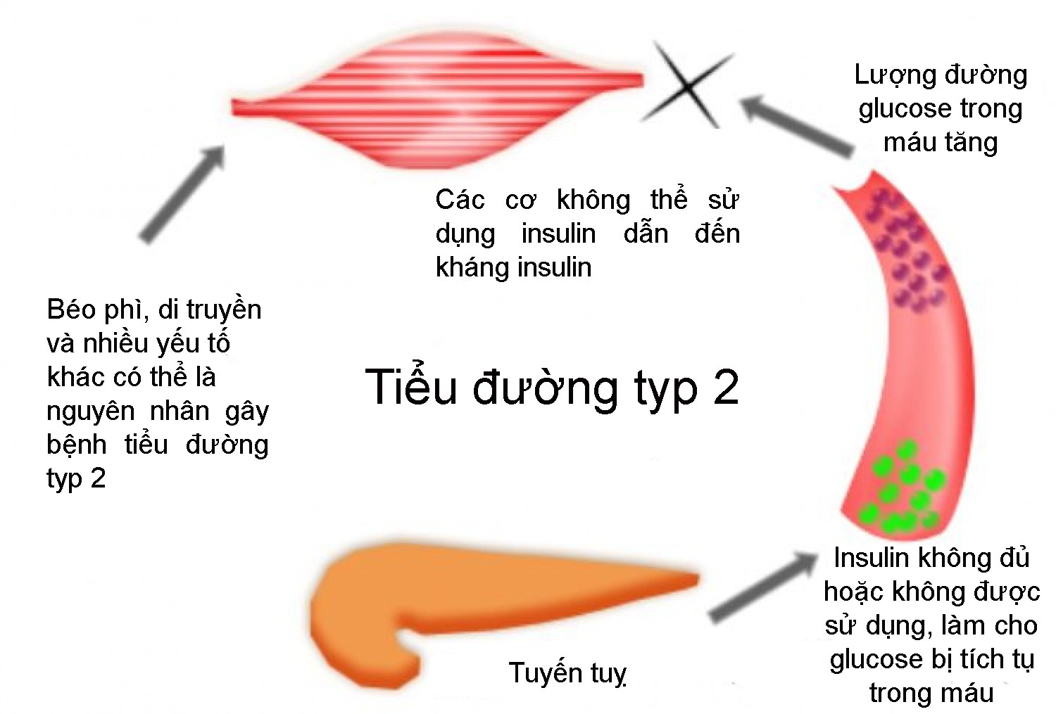 Nguyên nhân chính gây ra bệnh gai đen thường liên quan đến sự đề kháng insulin