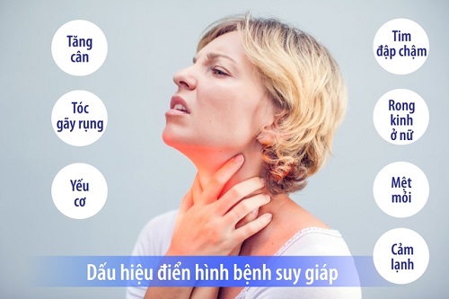 Những dấu hiệu điển hình khi bị suy giáp