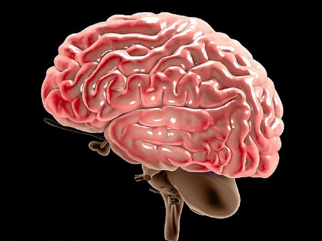 Dị dạng bán cầu não là gì?