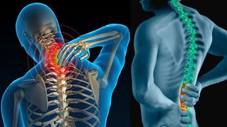 Triệu chứng đĩa đệm mất nước