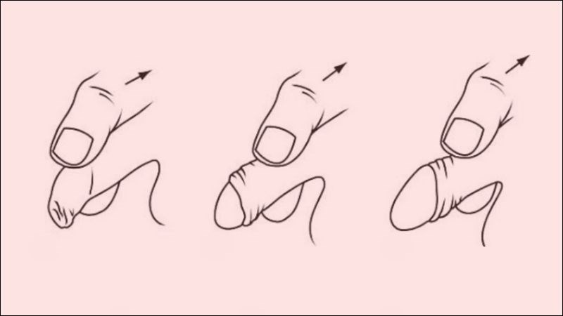 Điểm G của đàn ông nằm ở những vị trí nào trên cơ thể?