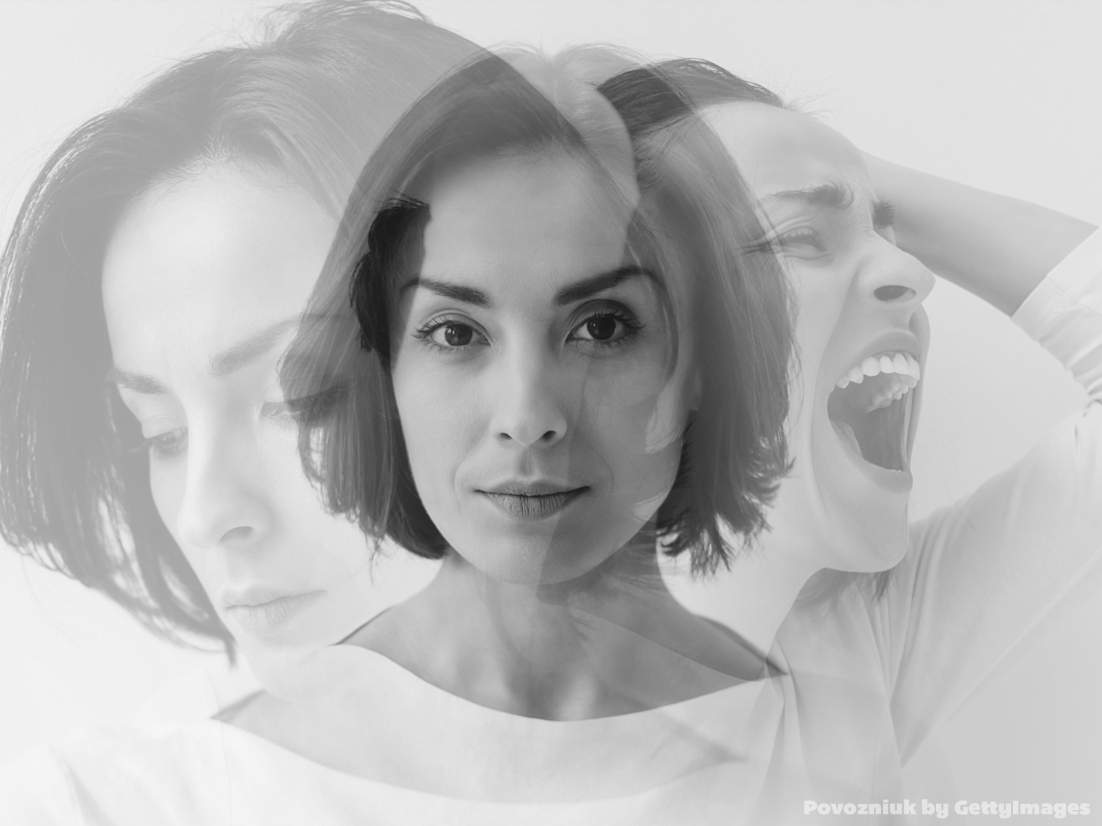 Sợ hãi hoặc vui bất chợt là triệu chứng khởi phát cơn động kinh thùy thái dương