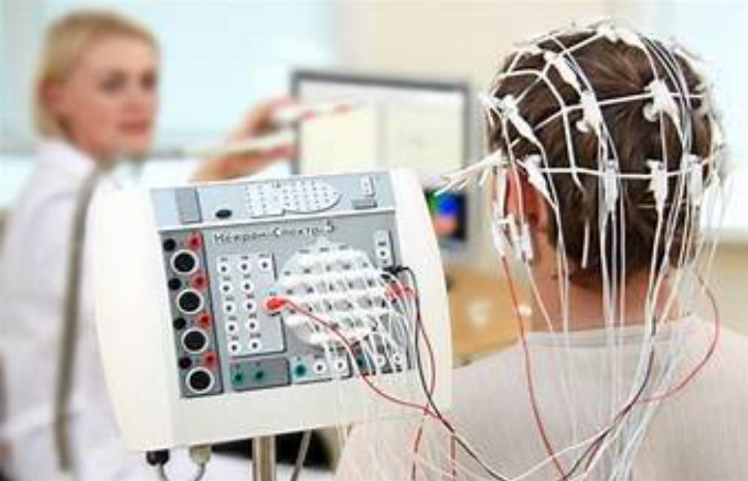 Điện não đồ (EEG) trong động kinh thùy thái dương