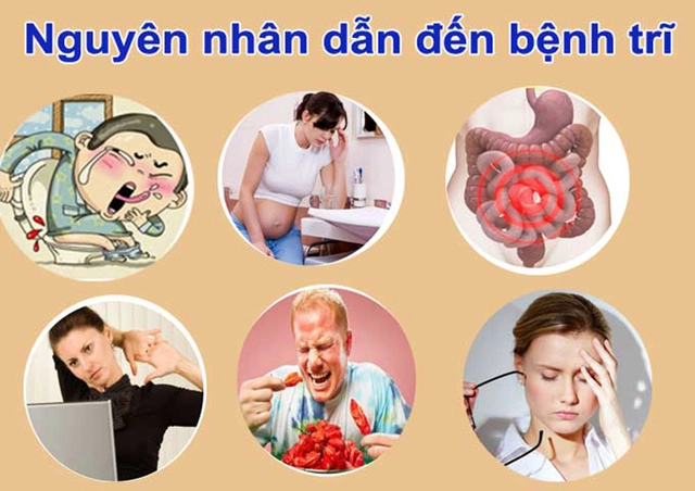 Nguyên nhân của bệnh trĩ