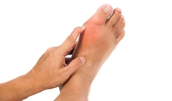 Sự lắng đọng tinh thể CPPD kéo dài làm bào mòn lớp sụn dẫn đến thoái hóa khớp nghiêm trọng