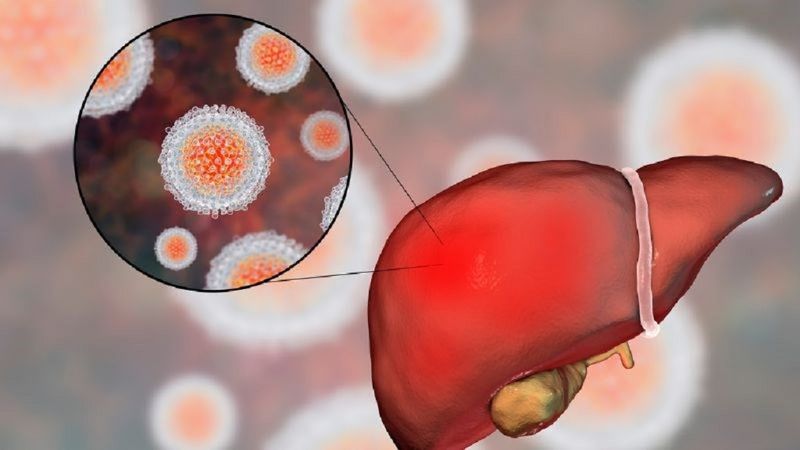 Việc nhận diện sớm các giai đoạn xơ gan giúp tăng cơ hội kiểm soát bệnh thành công 