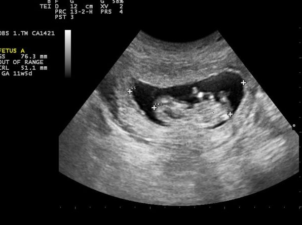 Em bé sẽ trải qua nhiều giai đoạn phát triển khác nhau từ khi diễn ra