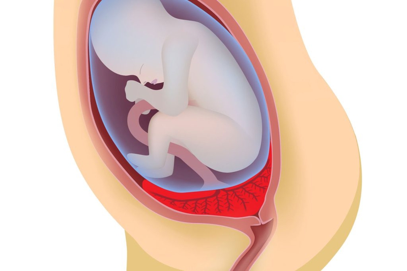 Hình minh họa khám thai định kỳ giúp bác sĩ đánh giá chính xác các yếu tố nguy cơ