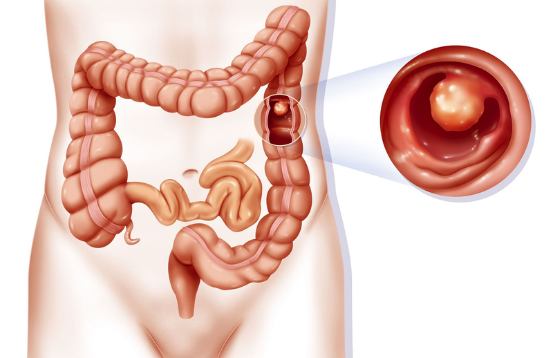 Hệ tiêu hóa của trẻ sơ sinh còn non nớt và dễ bị kích ứng
