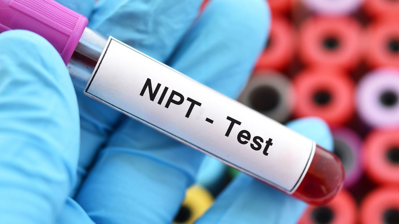 Xét nghiệm NIPT 